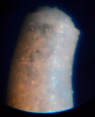 caecum da identificare